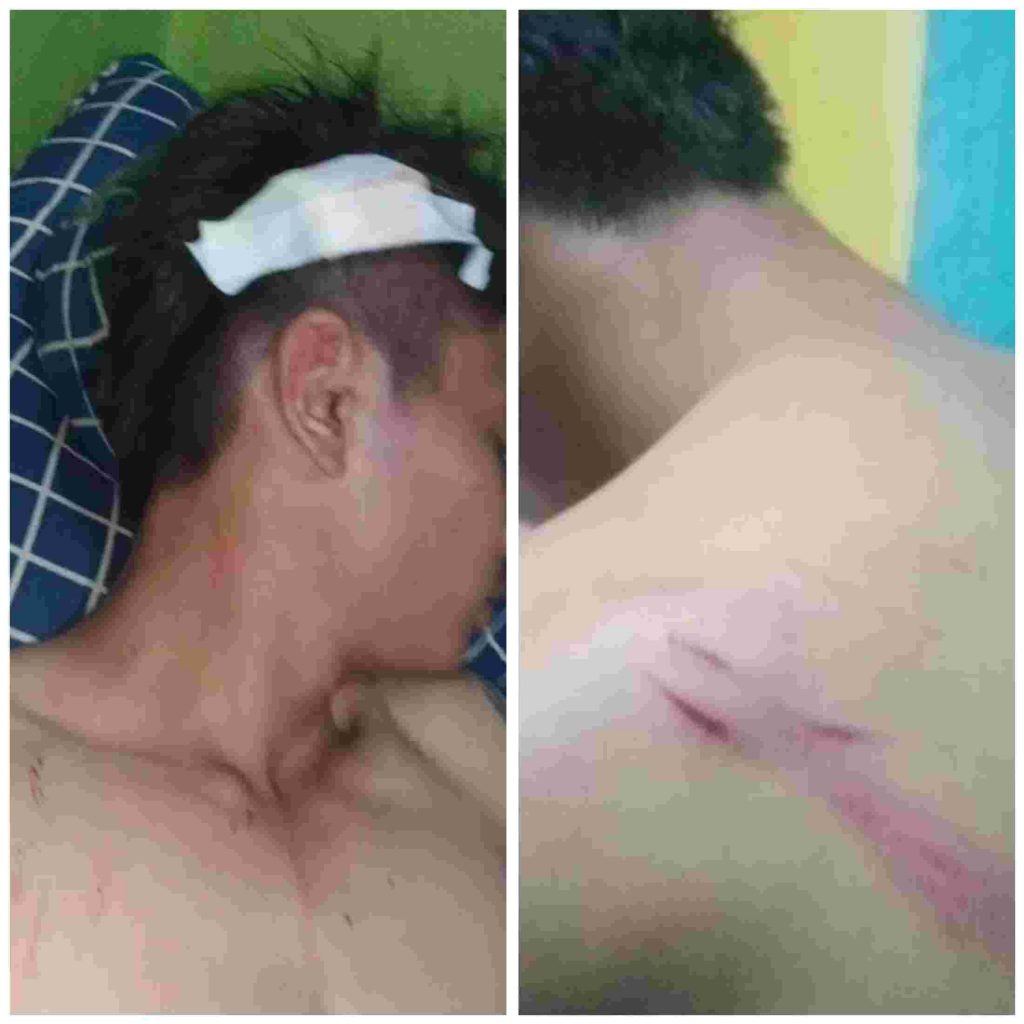 Diduga 2 Oknum Anggota Polisi Gorontalo Hajar Supir Taxi, Korban Pecah Kepala